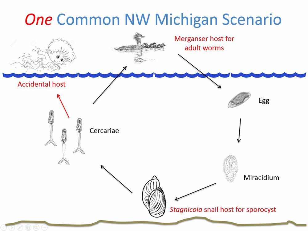 swimmers itch timeline